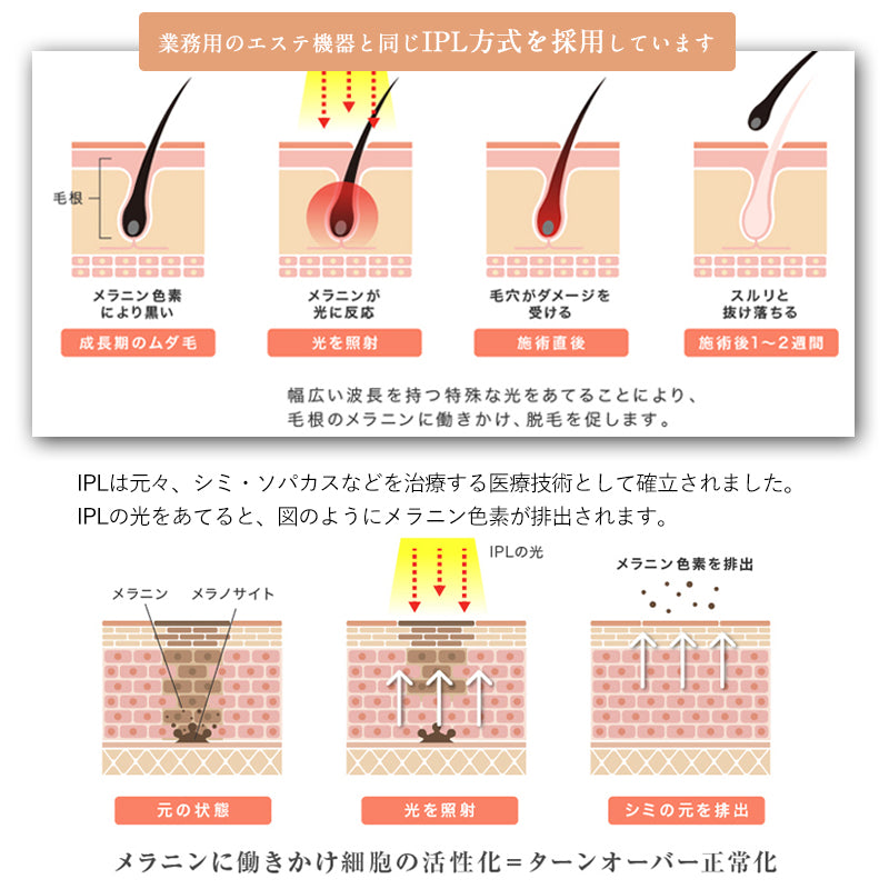 サファイヤ冷却 IPL 脱毛器 無痛 照射回数無制限 vio レディース メンズ レーザー 女性 家庭用 口ロミ 全身対応 ビキニ フラッシュ ムダ毛処理 顔 フェイス 脇 腕 指 美肌
