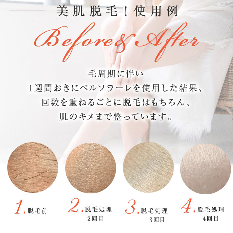 サファイヤ冷却 IPL 脱毛器 無痛 照射回数無制限 vio レディース メンズ レーザー 女性 家庭用 口ロミ 全身対応 ビキニ フラッシュ ムダ毛処理 顔 フェイス 脇 腕 指 美肌