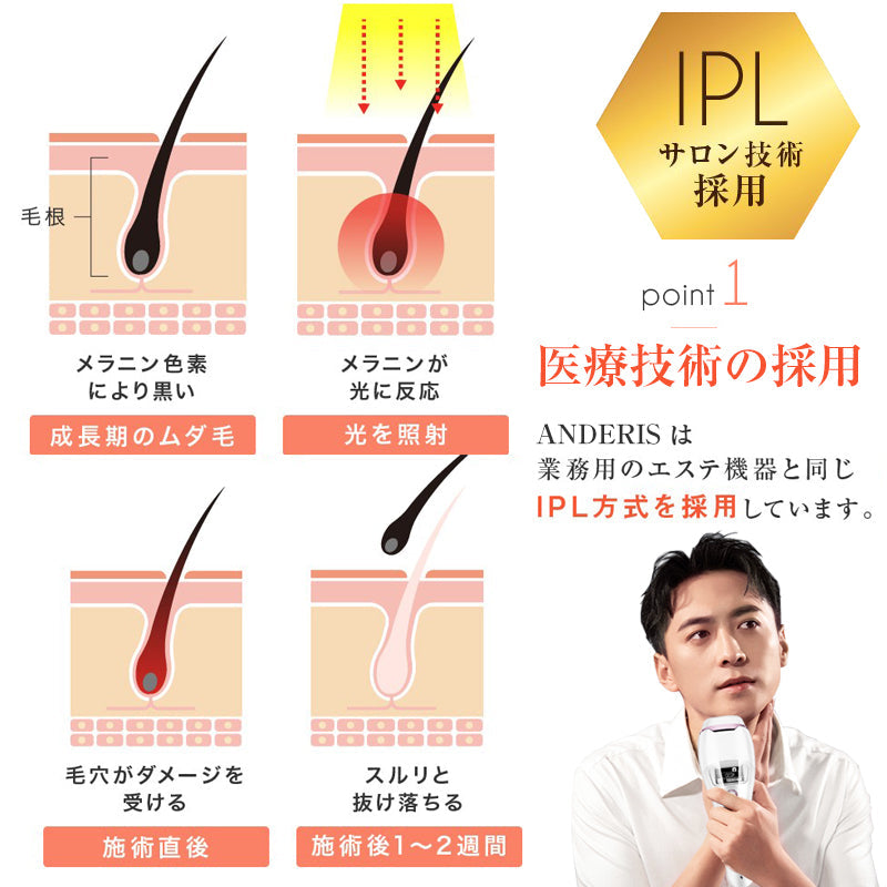 サファイヤ冷却 IPL 脱毛器 無痛 照射回数無制限 vio レディース メンズ レーザー 女性 家庭用 口ロミ 全身対応 ビキニ フラッシュ ムダ毛処理 顔 フェイス 脇 腕 指 美肌