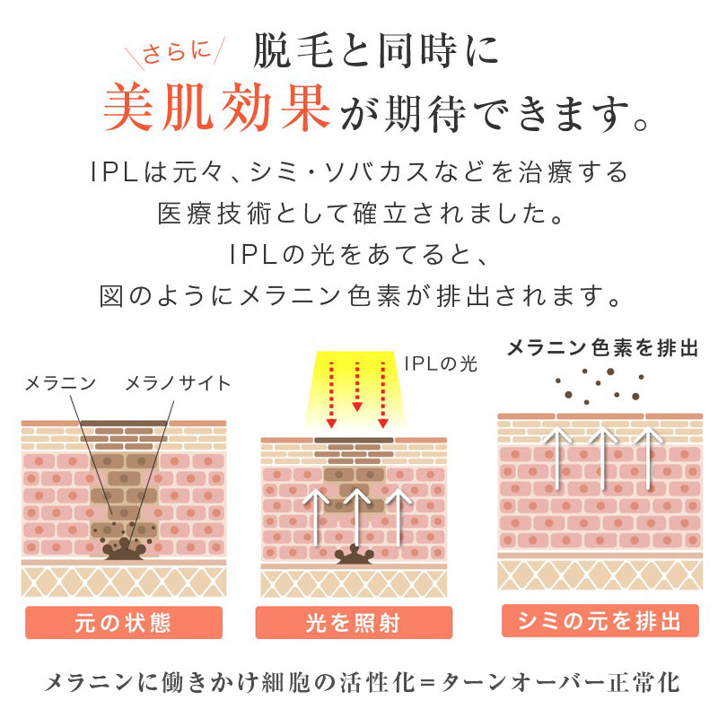 サファイヤ冷却 IPL 脱毛器 無痛 照射回数無制限 vio レディース メンズ レーザー 女性 家庭用 口ロミ 全身対応 ビキニ フラッシュ ムダ毛処理 顔 フェイス 脇 腕 指 美肌