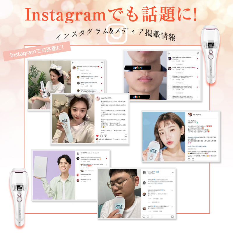 サファイヤ冷却 IPL 脱毛器 無痛 照射回数無制限 vio レディース メンズ レーザー 女性 家庭用 口ロミ 全身対応 ビキニ フラッシュ ムダ毛処理 顔 フェイス 脇 腕 指 美肌